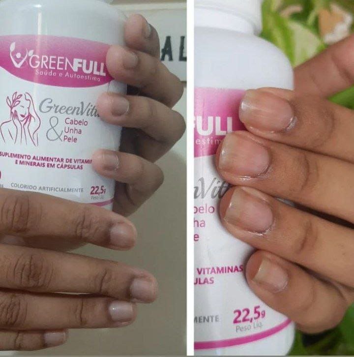 Greenvita Suplemento vitaminico - Imagen 3